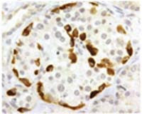 SSTR3 Antibody in Immunohistochemistry (IHC)