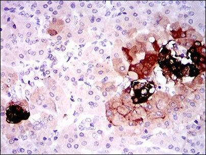 Somatostatin Antibody in Immunohistochemistry (Paraffin) (IHC (P))