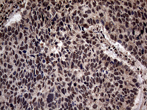 SSU72 Antibody in Immunohistochemistry (Paraffin) (IHC (P))