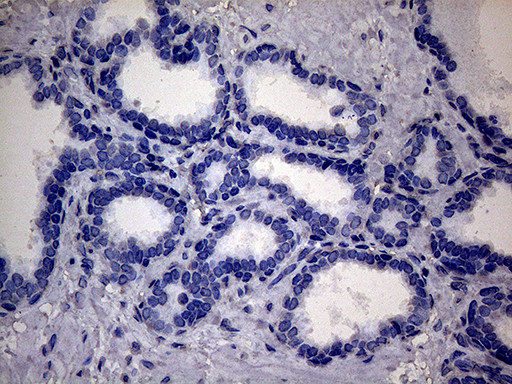 SSU72 Antibody in Immunohistochemistry (Paraffin) (IHC (P))