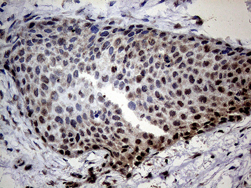 SSU72 Antibody in Immunohistochemistry (Paraffin) (IHC (P))