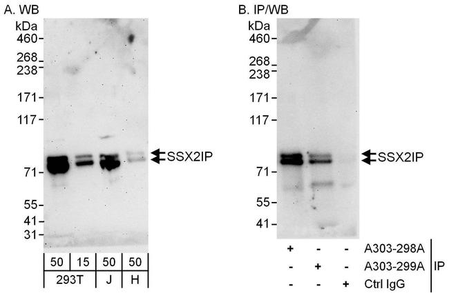 SSX2IP Antibody in Western Blot (WB)