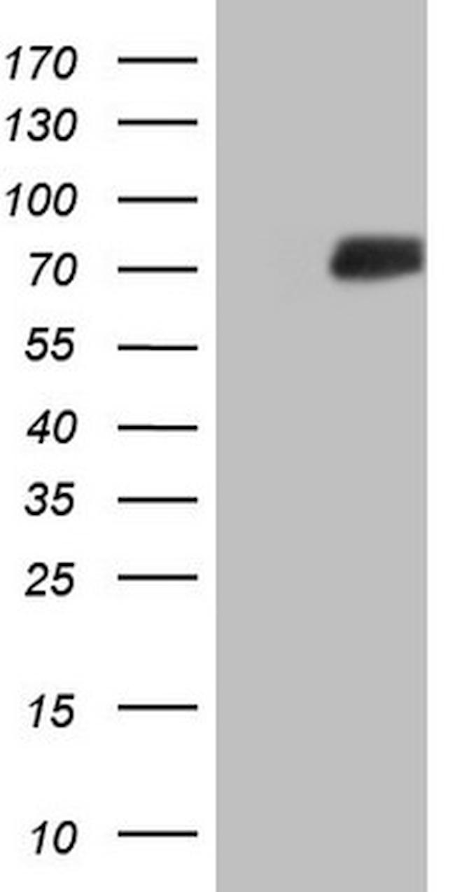 SSX2IP Antibody in Western Blot (WB)