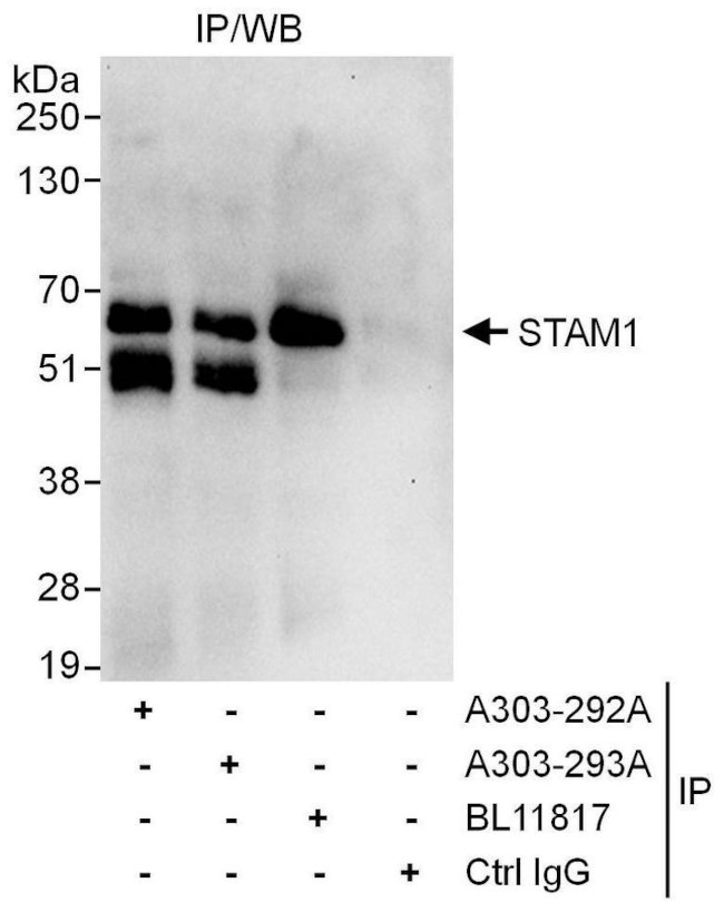 STAM1 Antibody in Immunoprecipitation (IP)