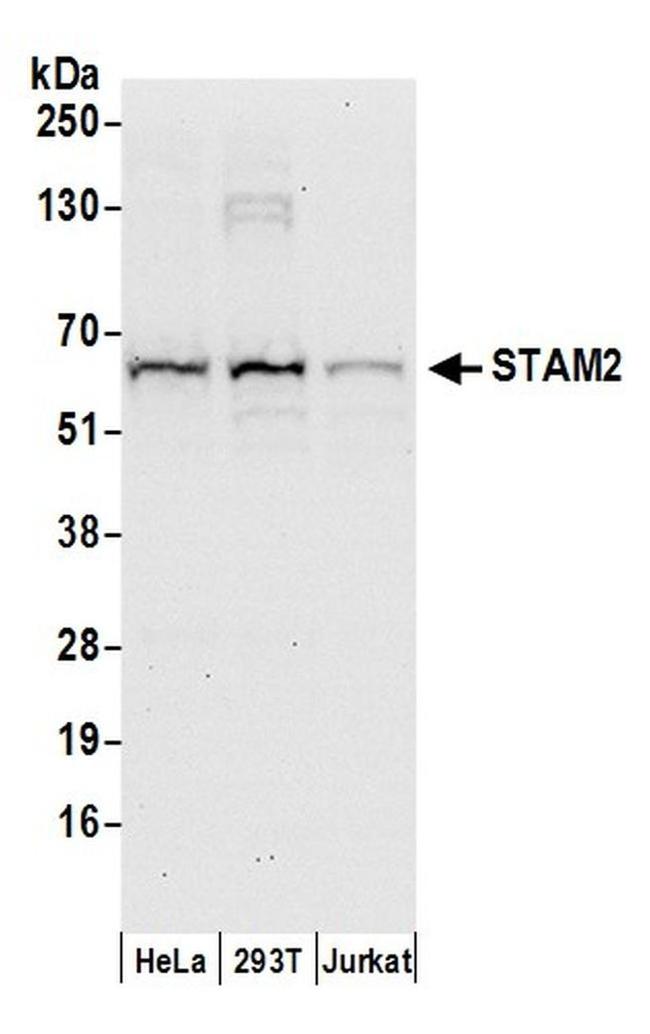 STAM2 Antibody in Western Blot (WB)