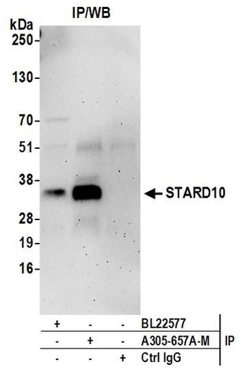 STARD10 Antibody in Immunoprecipitation (IP)