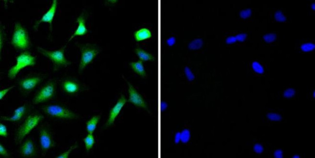 STAT1 Antibody in Immunocytochemistry (ICC/IF)