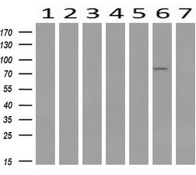 STAT1 Antibody in Western Blot (WB)