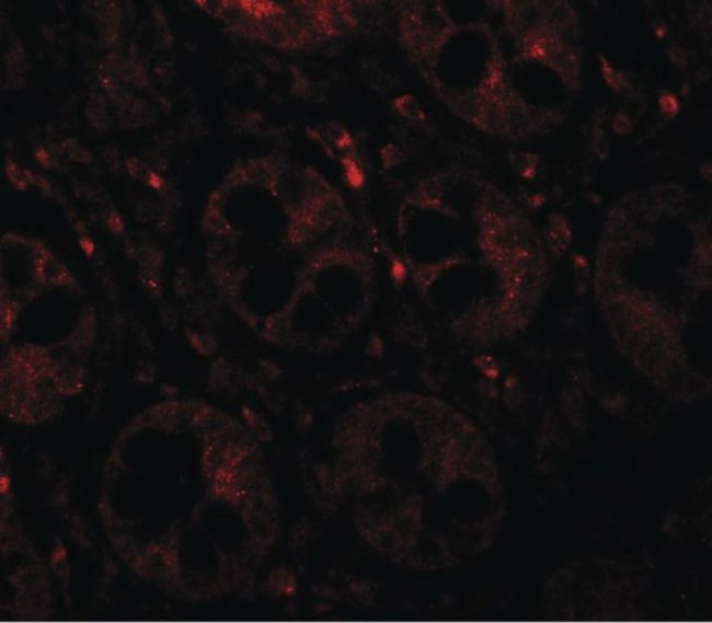 STAT1 Antibody in Immunohistochemistry (IHC)