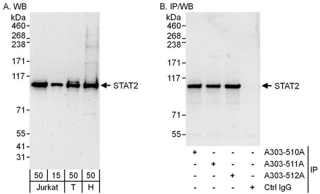 STAT2 Antibody in Western Blot (WB)