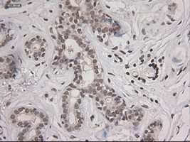 STAT3 Antibody in Immunohistochemistry (Paraffin) (IHC (P))