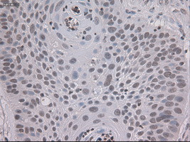 STAT3 Antibody in Immunohistochemistry (Paraffin) (IHC (P))