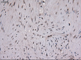 STAT3 Antibody in Immunohistochemistry (Paraffin) (IHC (P))