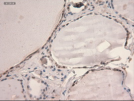 STAT3 Antibody in Immunohistochemistry (Paraffin) (IHC (P))