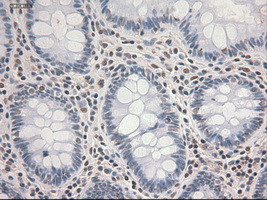 STAT3 Antibody in Immunohistochemistry (Paraffin) (IHC (P))