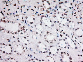 STAT3 Antibody in Immunohistochemistry (Paraffin) (IHC (P))