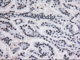 STAT3 Antibody in Immunohistochemistry (Paraffin) (IHC (P))