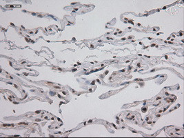 STAT3 Antibody in Immunohistochemistry (Paraffin) (IHC (P))