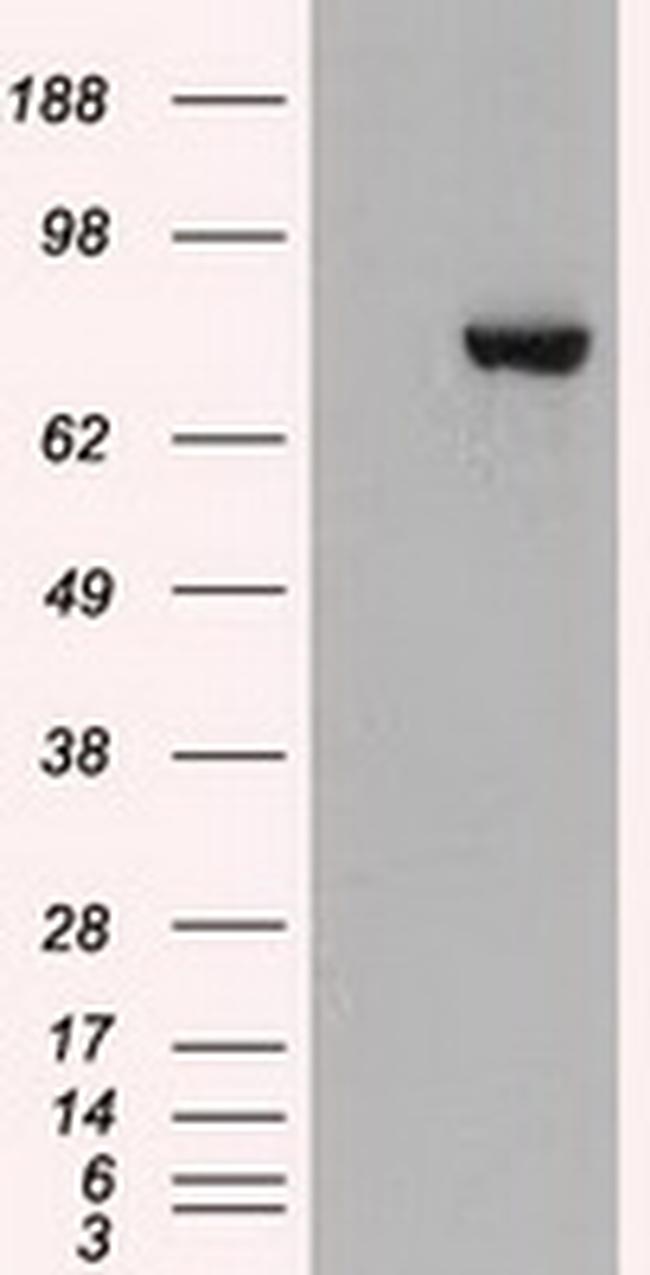 STAT3 Antibody in Western Blot (WB)