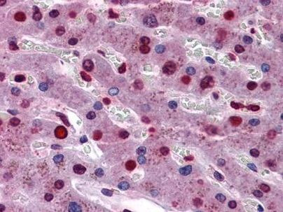 STAT3 Antibody in Immunohistochemistry (Paraffin) (IHC (P))