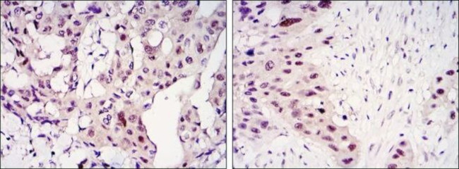 STAT3 Antibody in Immunohistochemistry (Paraffin) (IHC (P))