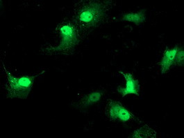 STAT4 Antibody in Immunocytochemistry (ICC/IF)