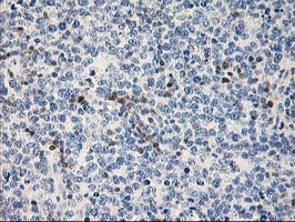 STAT4 Antibody in Immunohistochemistry (Paraffin) (IHC (P))