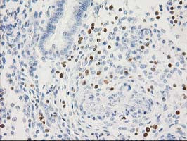 STAT4 Antibody in Immunohistochemistry (Paraffin) (IHC (P))