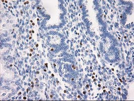 STAT4 Antibody in Immunohistochemistry (Paraffin) (IHC (P))