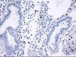 STAT4 Antibody in Immunohistochemistry (Paraffin) (IHC (P))