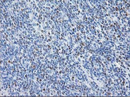 STAT4 Antibody in Immunohistochemistry (Paraffin) (IHC (P))