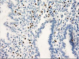 STAT4 Antibody in Immunohistochemistry (Paraffin) (IHC (P))