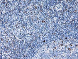 STAT4 Antibody in Immunohistochemistry (Paraffin) (IHC (P))