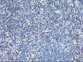 STAT4 Antibody in Immunohistochemistry (Paraffin) (IHC (P))