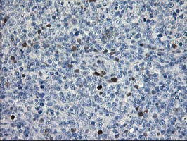 STAT4 Antibody in Immunohistochemistry (Paraffin) (IHC (P))