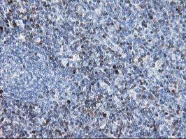 STAT4 Antibody in Immunohistochemistry (Paraffin) (IHC (P))