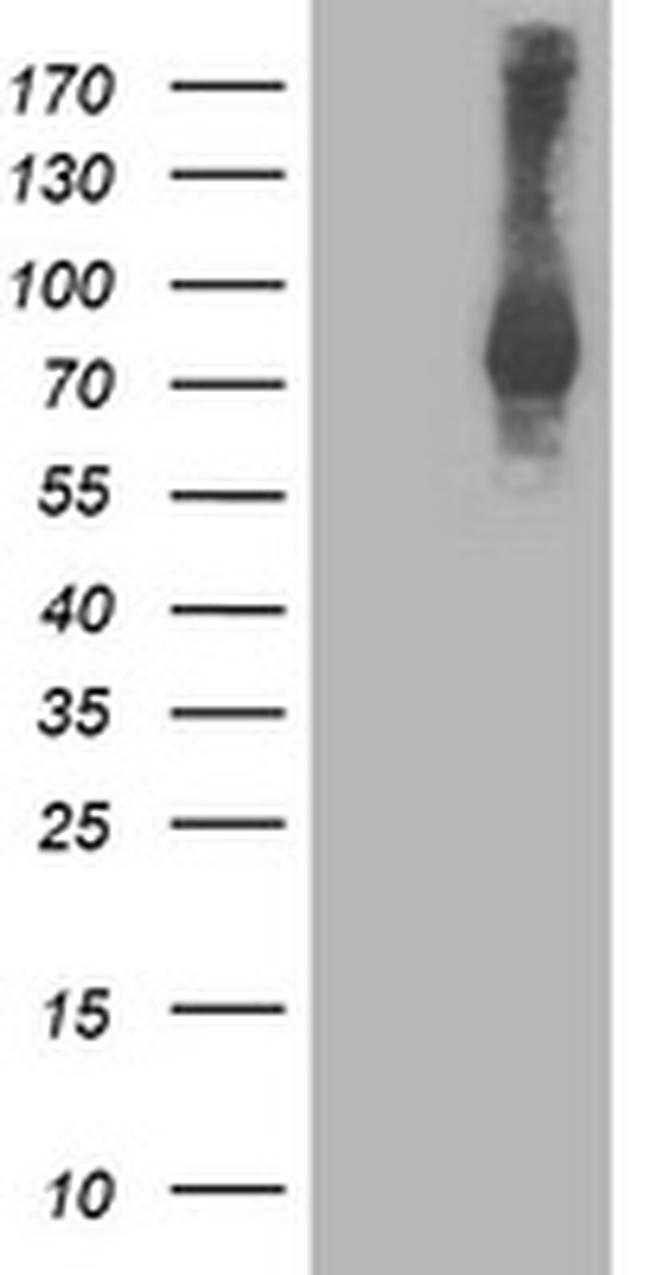 STAT4 Antibody in Western Blot (WB)