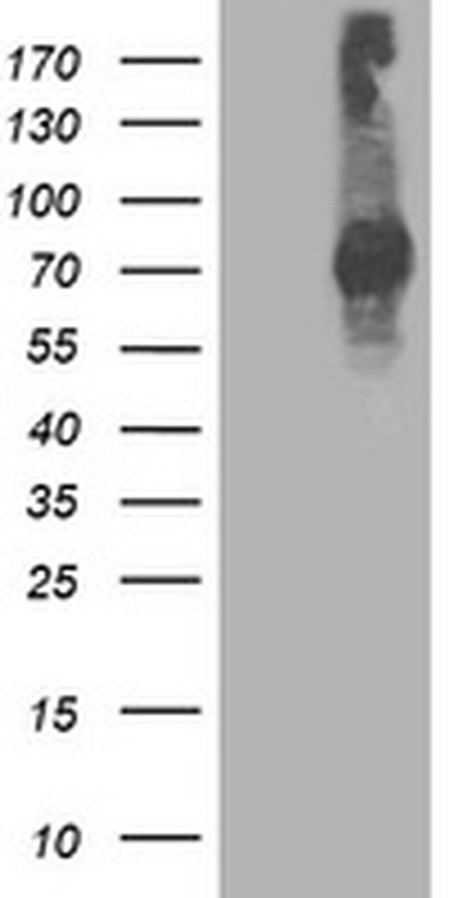 STAT4 Antibody in Western Blot (WB)