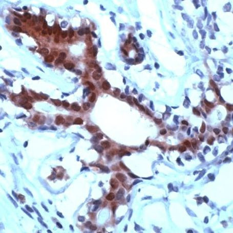 STAT5 alpha Antibody in Immunohistochemistry (IHC)