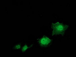 STAT5A Antibody in Immunocytochemistry (ICC/IF)