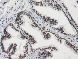 STAT5A Antibody in Immunohistochemistry (Paraffin) (IHC (P))