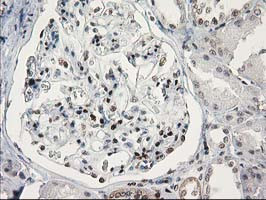 STAT5A Antibody in Immunohistochemistry (Paraffin) (IHC (P))