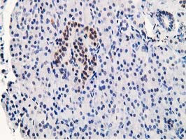 STAT5A Antibody in Immunohistochemistry (Paraffin) (IHC (P))
