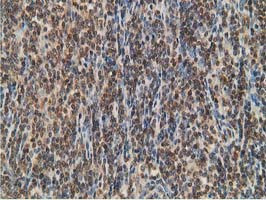 STAT5A Antibody in Immunohistochemistry (Paraffin) (IHC (P))