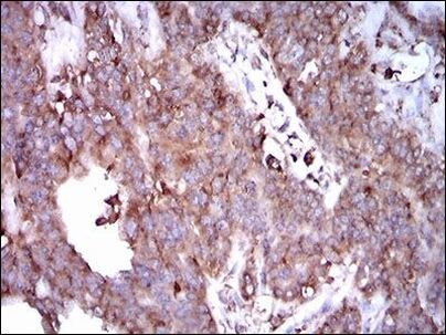 STAT5 alpha Antibody in Immunohistochemistry (Paraffin) (IHC (P))