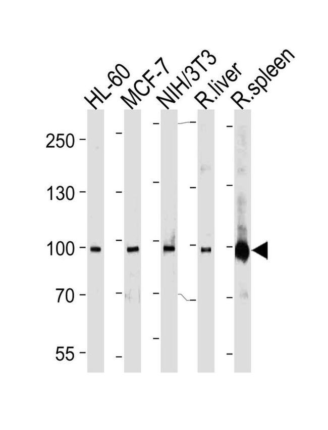 STAT5 beta Antibody in Western Blot (WB)