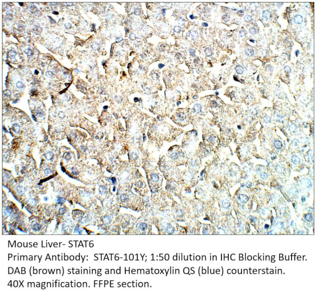STAT6 Antibody in Immunohistochemistry (IHC)