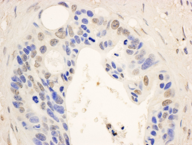 STAT6 Antibody in Immunohistochemistry (IHC)