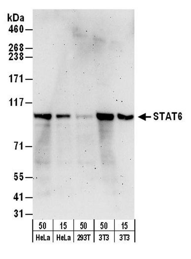 STAT6 Antibody in Western Blot (WB)