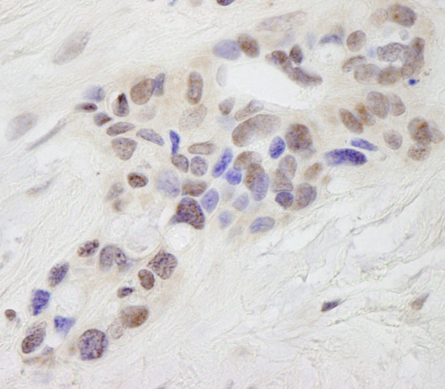 STAT6 Antibody in Immunohistochemistry (IHC)